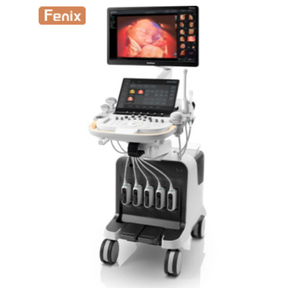 Máy siêu âm Sonoscape P80 Elite